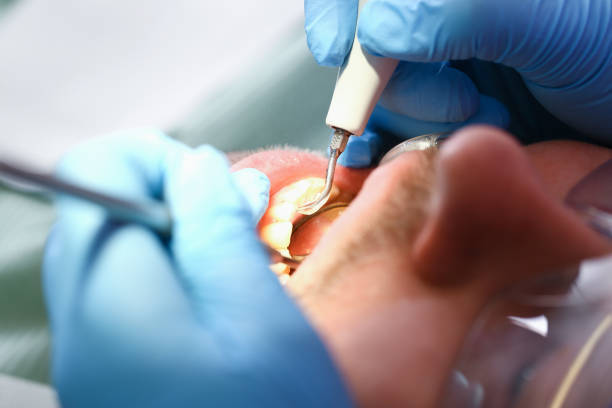 Best Emergency Treatment for Toothache in Gulfport, FL